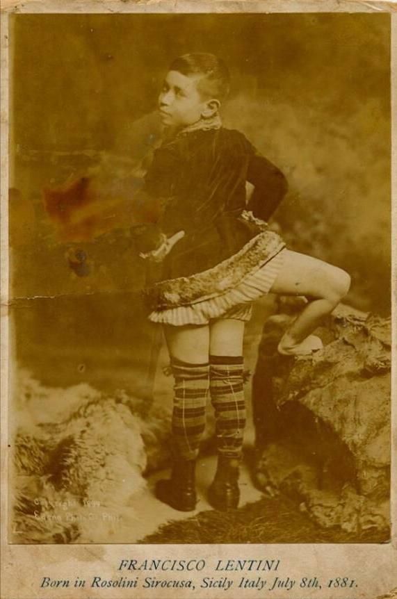 他是美国马戏圈里的“国王”，拥有三条腿，结过两次婚，活了77岁