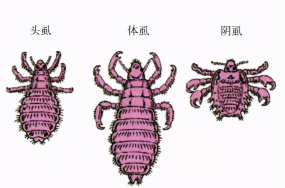 儿童睫毛上一窝阴虱,4岁宝宝睫毛爬满阴虱