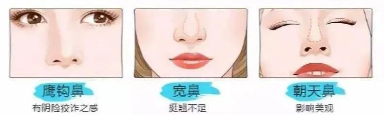 如何拯救扁塌鼻,改善塌鼻梁大鼻头
