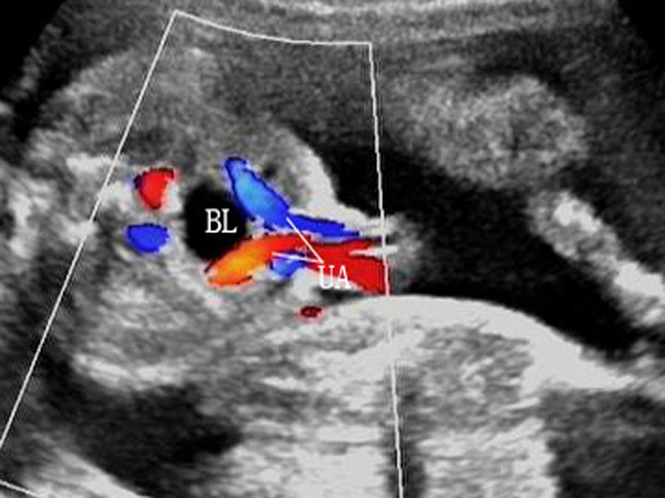 孕期不能忽视的胎儿超声检查,胎儿超声检查报告表