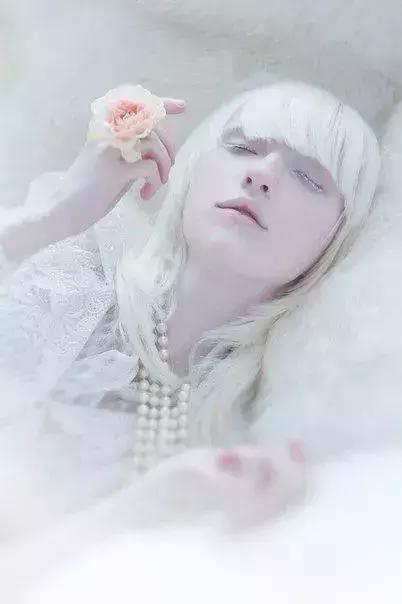 全身黑斑被骂“斑点狗”，身高160的她却成为最美超模…