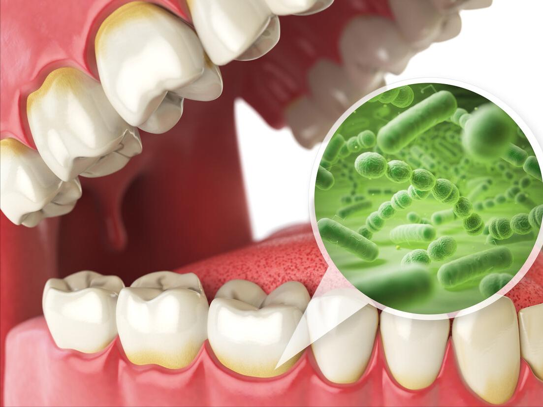 有口臭怎么办最快最有效的方法,有口臭怎么样治愈得快呢