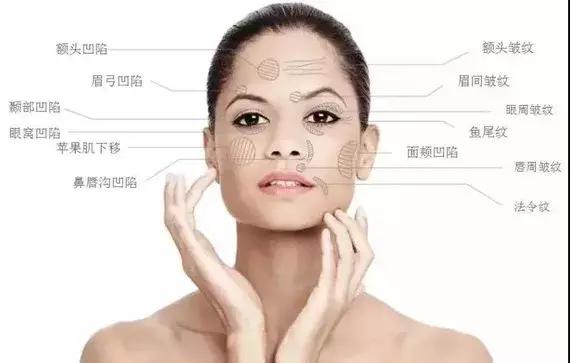 王菲打的童颜针啥牌子,王菲填充太阳穴童颜针