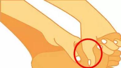 脚型不好看怎么办,脚臭不敢露是什么原因