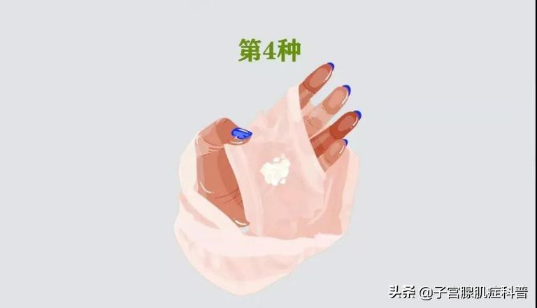 女士裤头有白带什么原因,女性裤头上带有褐色血渍什么原因