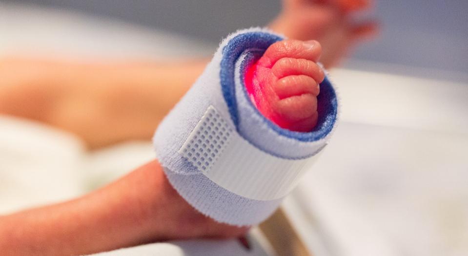 33周早产儿如何预防缺氧,32周早产儿危险期为多少天