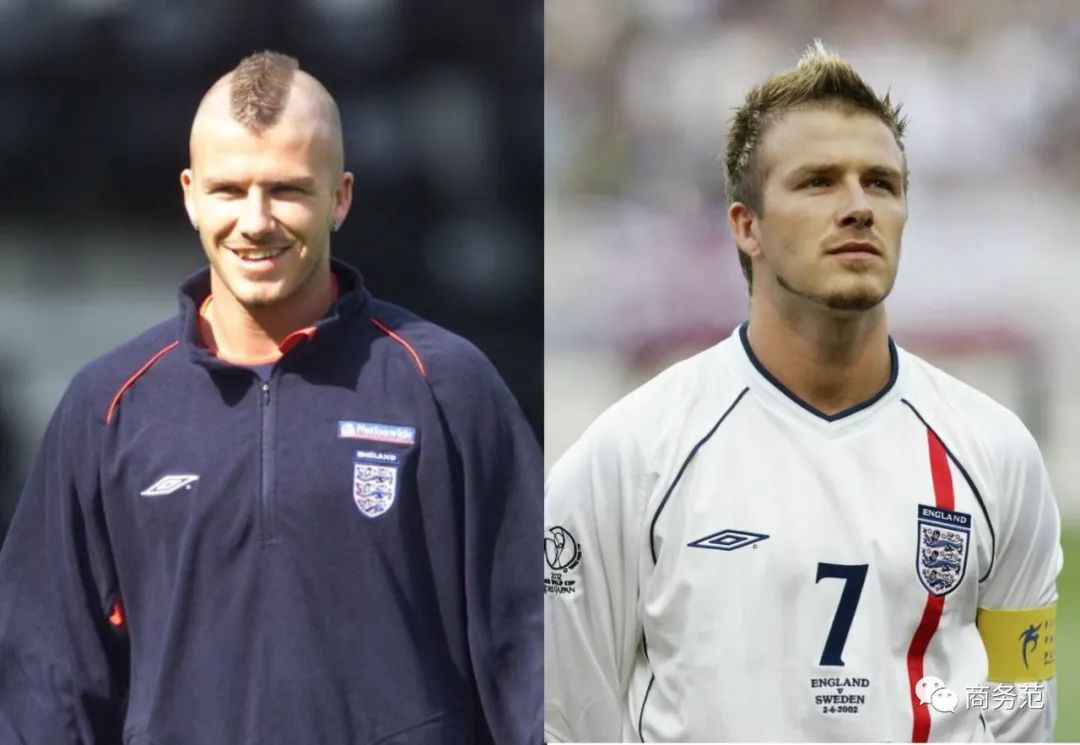 贝克汉姆自曝患上脱发症,贝克汉姆脱发照片