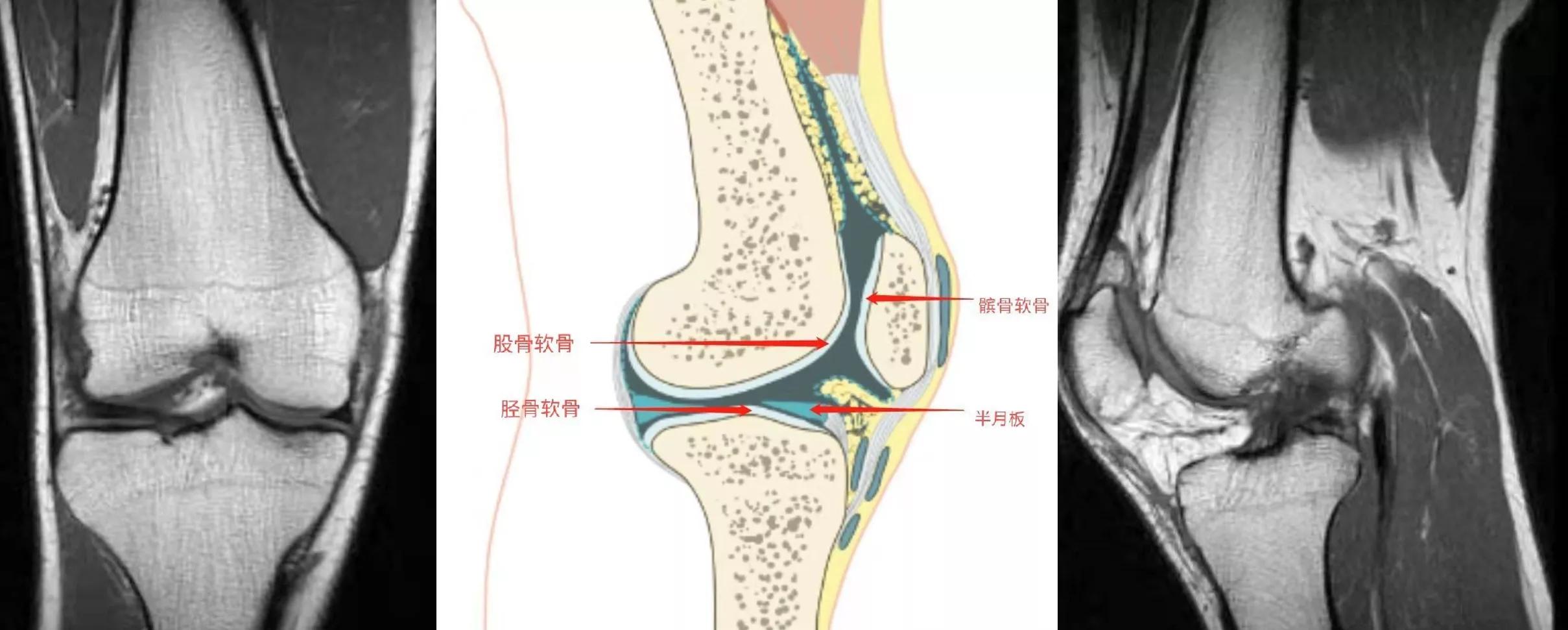 钓鱼手肘痛是什么原因,钓鱼为什么手臂疼痛