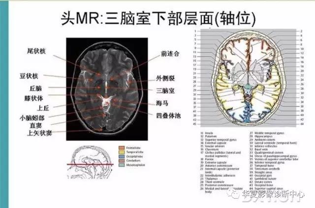 mra头颅解剖学详细讲解视频,常见的头颅mri图像