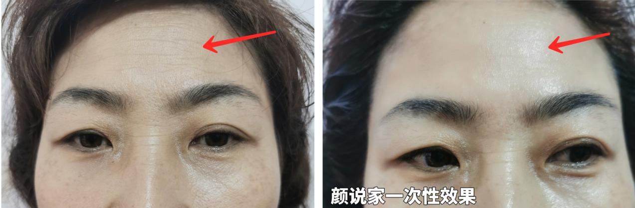 微商选择好产品的十大标准,2020年微商选什么产品