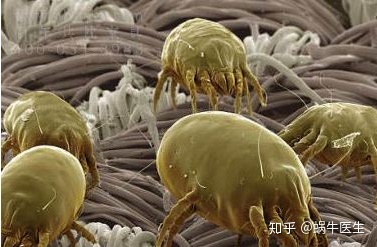 头皮除螨虫的正确方法,头皮上有螨虫用什么方法解决