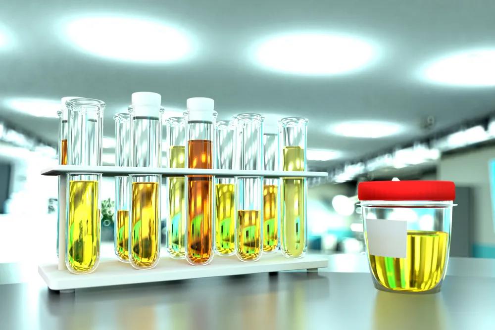 小便的颜色代表什么,小便的颜色代表什么样的病