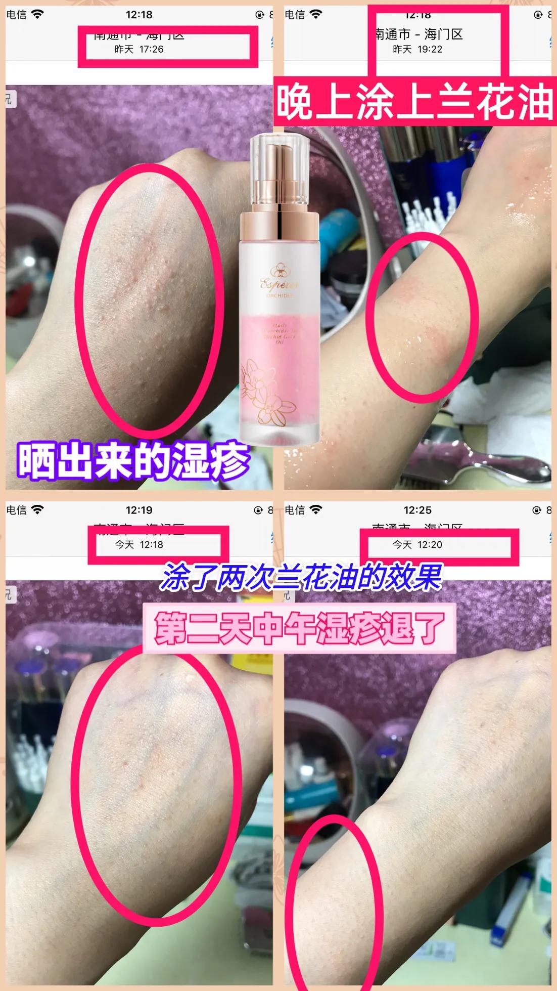 精华油天花板,精华液天花板