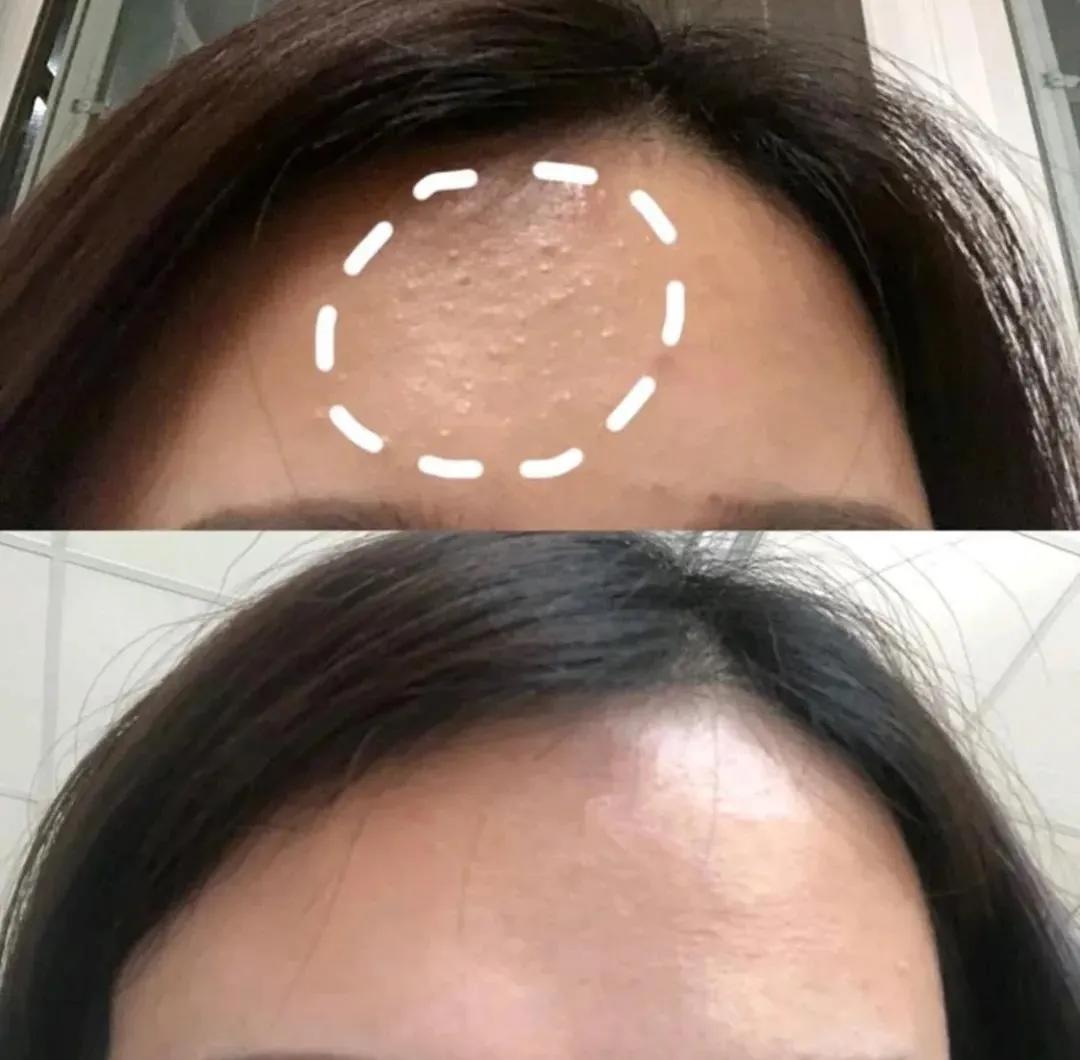 说了一万遍的闭口问题,今天就来说一说