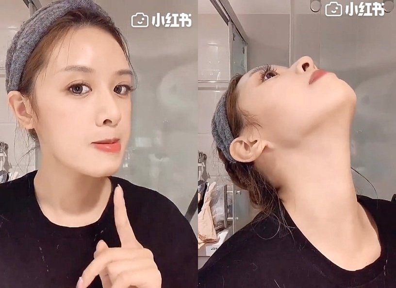 练精致下颚线,徐睿知脸部提升