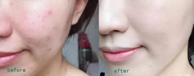 适合学生党用的bb霜,用起来自然水润的bb霜