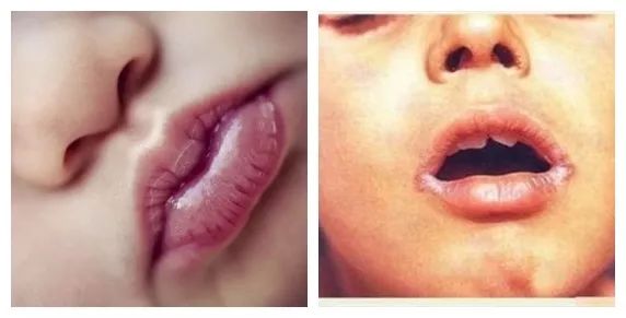 滋润保湿告别干燥起皮,保湿提亮肤色改善起皮防干裂