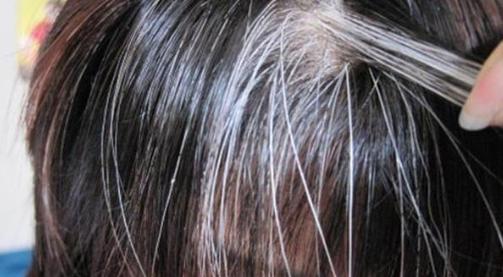 天天吃黑芝麻、黑米，真能减少白发？营养师：滋养黑发的是“它”