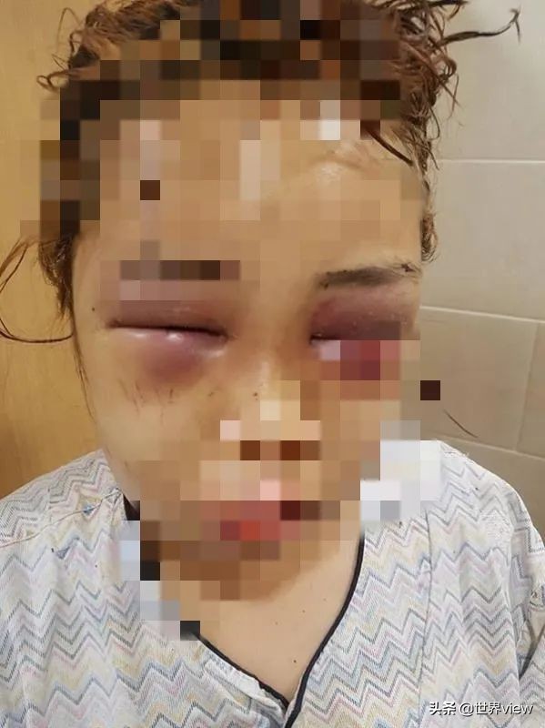 韩国霸凌亲身经历,在韩国霸凌真的那么严重吗