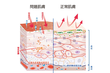 面部红血丝角质层太薄,角质层太薄怎么做深层清洁