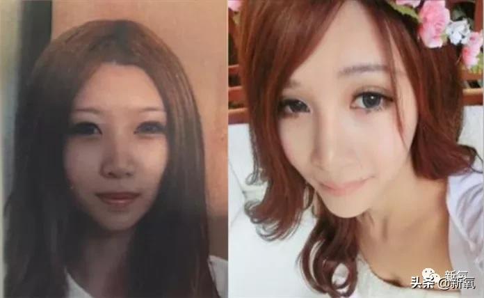 网红整鼻子整出坑,千万网红被坑