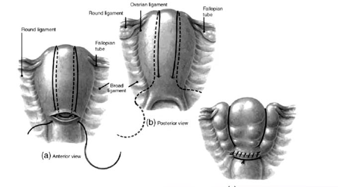 产后出血护理措施不包括,羊产后出血治疗土办法