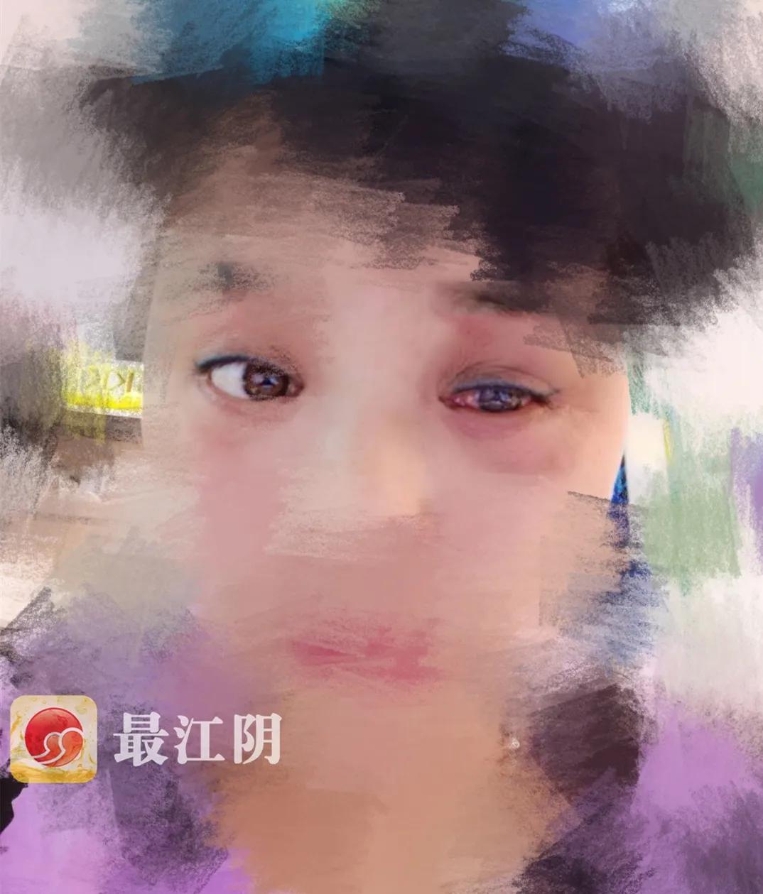 美容店毁容女孩,美容店的毁容事件