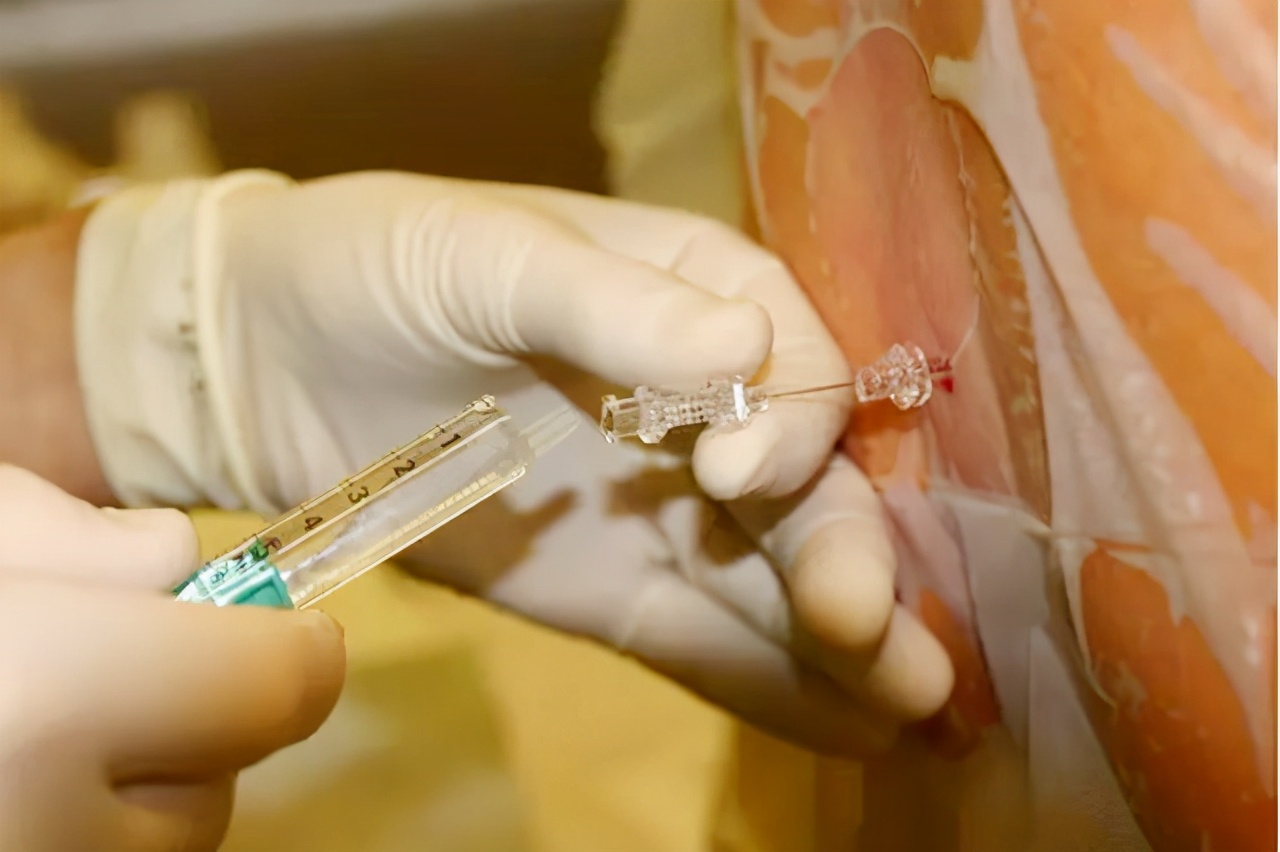 梅毒历史解说视频,历史上的梅毒怎么消灭的