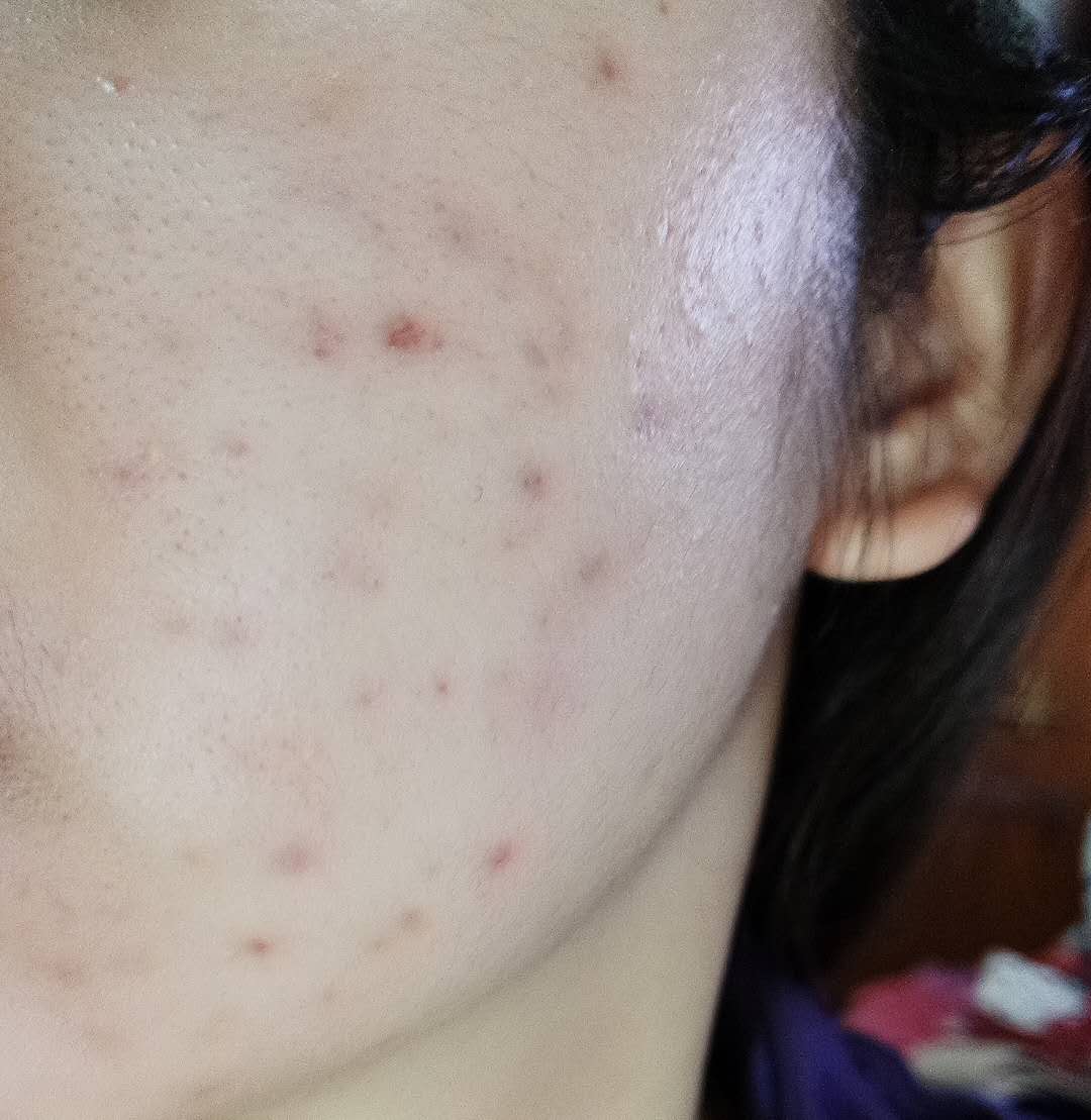 津尔氏薰衣草金缕梅爽肤水怎么样,津尔氏面膜测评