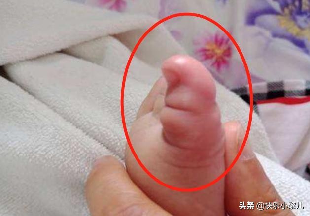4岁宝宝的脚趾头有弯曲变形,4岁宝宝脚变形图片