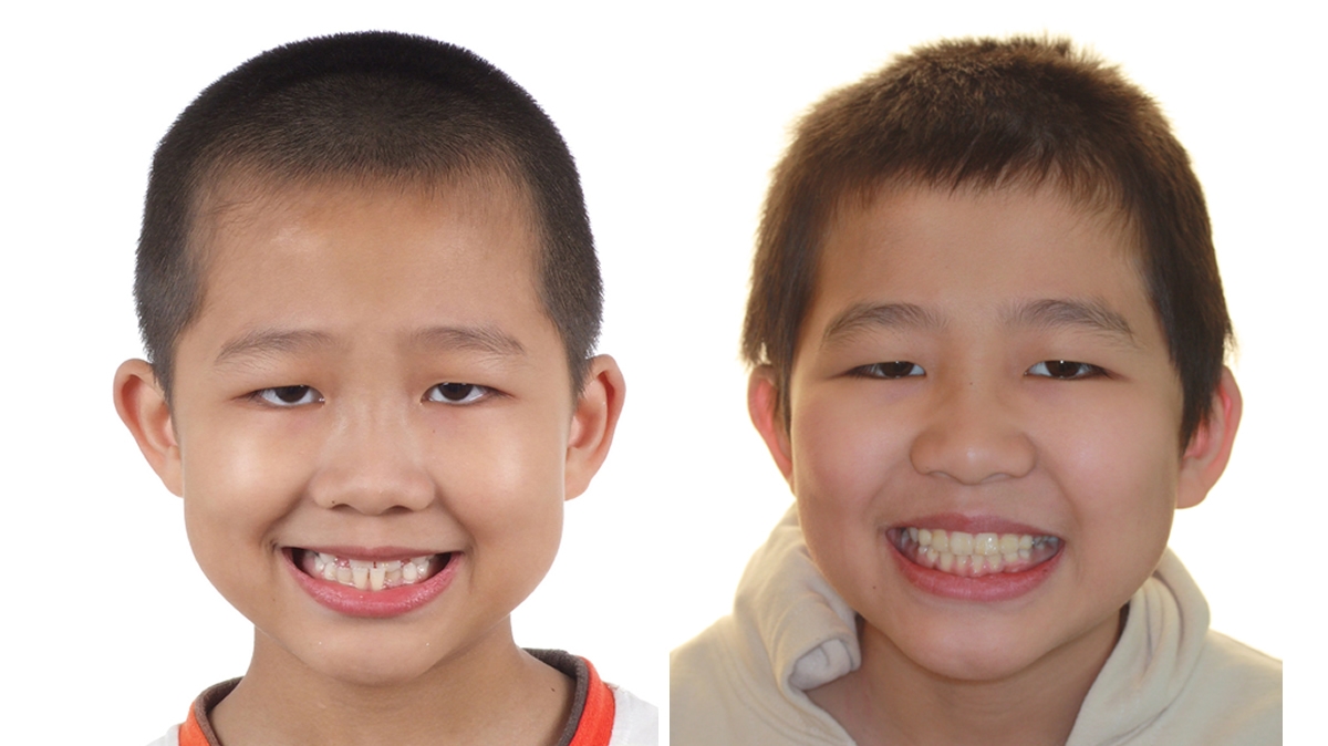 三岁宝宝护理常识,3-6岁宝宝常见的家庭护理