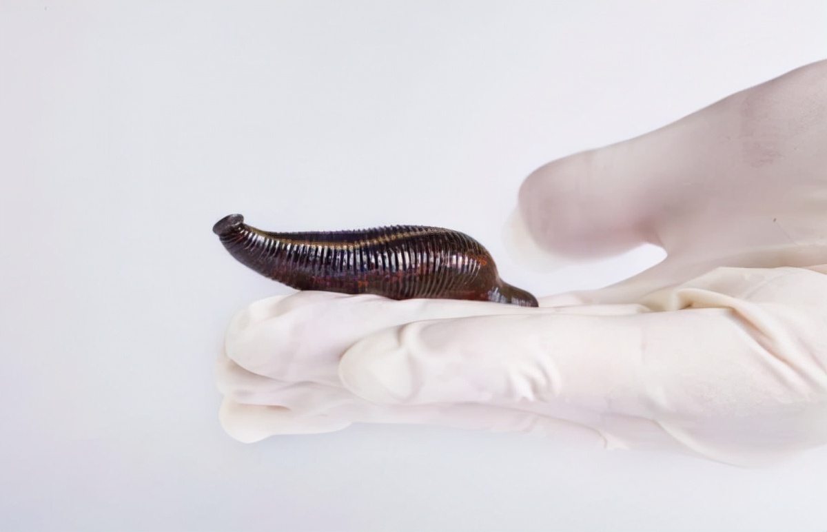 蚂蟥吃进肚子会繁殖吗,蚂蟥吃进胃里的后果