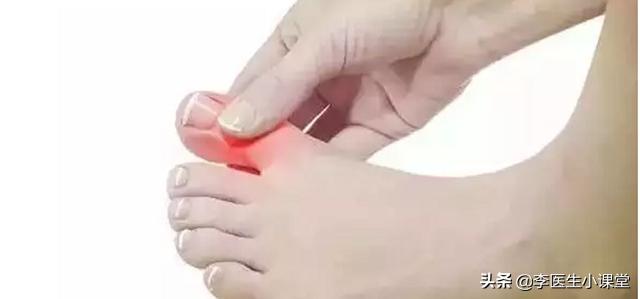 维生素b和叶酸饭前吃还是饭后,维生素c和叶酸选哪个