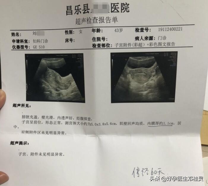 月经淋漓不尽一个多月偶有血块,月经淋漓不尽一个月小腹坠痛