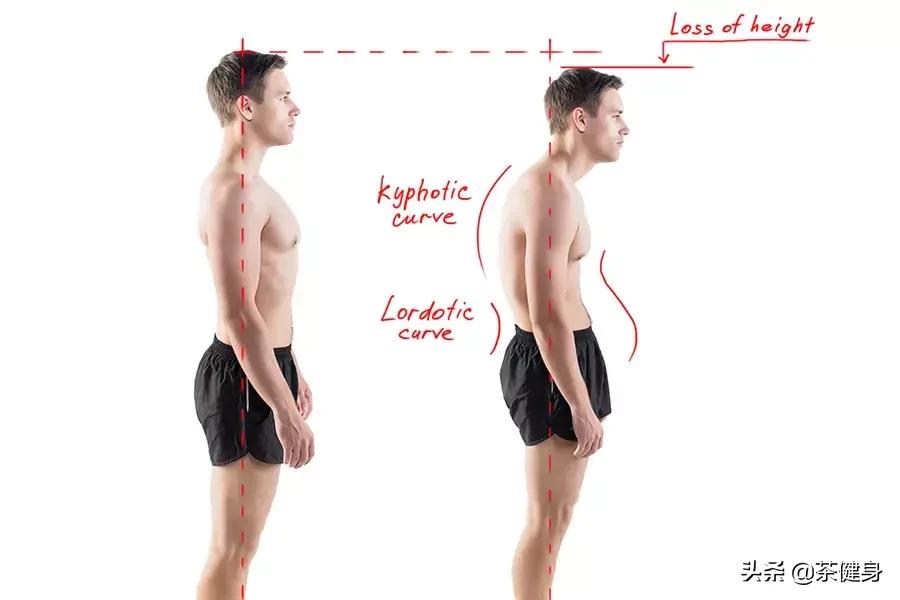 三分钟矫正不良体态,每天10分钟帮你纠正错误体态