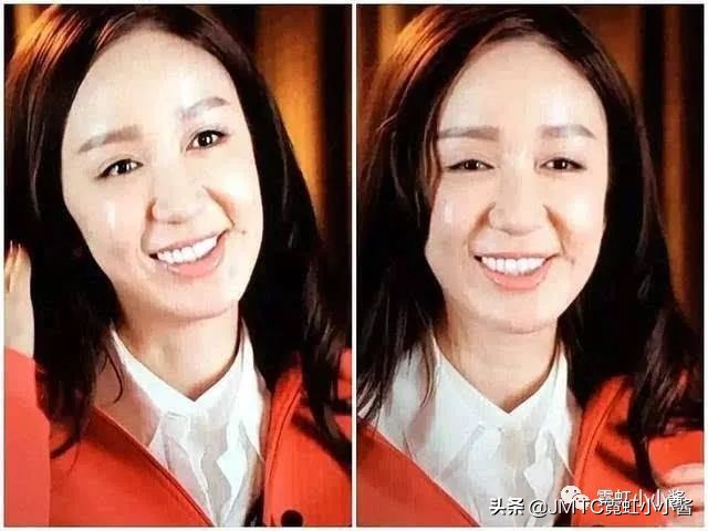 25岁抗老拯救垮脸,哪种脸型抗衰抗皱