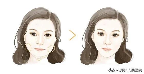 该怎么拯救瘦长脸,如何拯救抬头纹