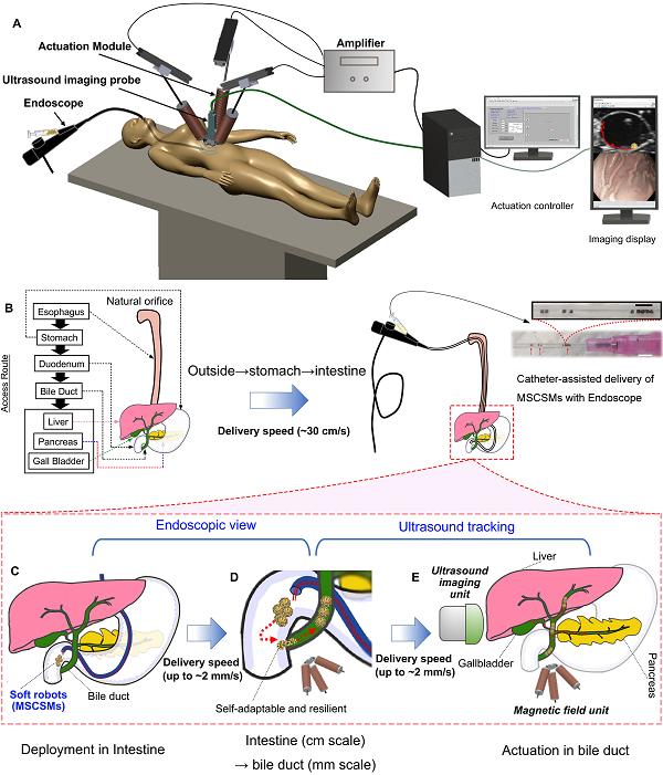 微型机器人和传统机器人结合实现体内狭小腔道的快速高精度递送