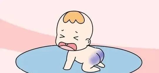 宝宝身上青斑解释,孩子身上的青胎记都是蒙古斑吗