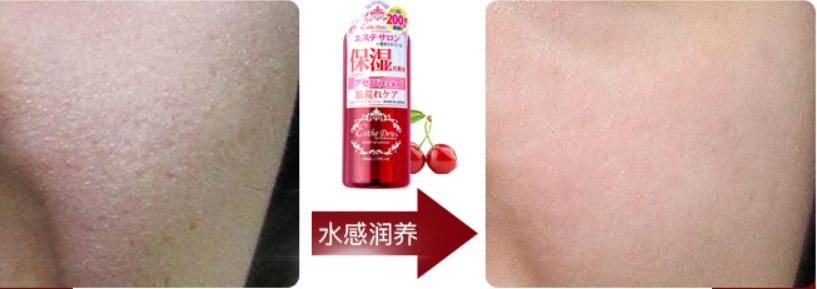 网红达人李喵喵在用的爽肤水,用后干燥暗沉不见了,脸蛋白嫩了