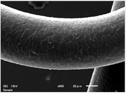 头发干枯毛躁是什么原因导致的,拉头发发尾毛躁是什么原因