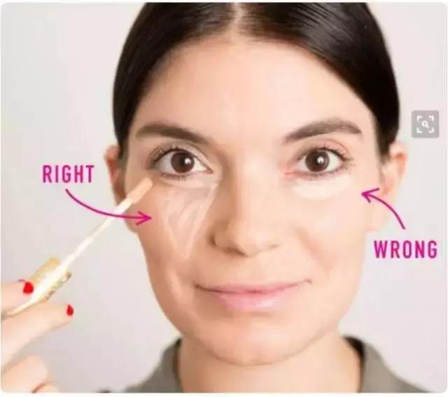 黑眼圈淡斑,色素型黑眼圈太重怎么调理