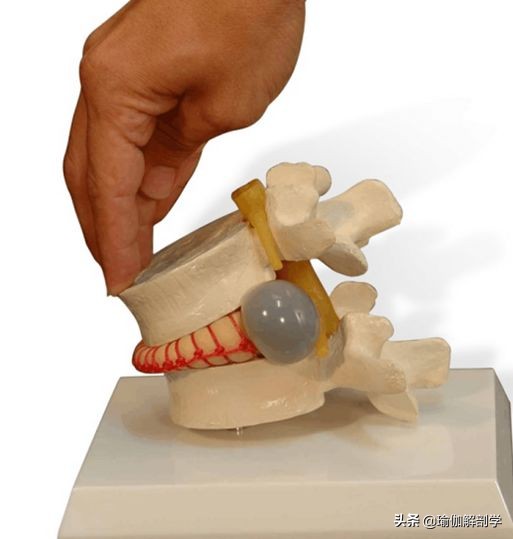 腰椎间盘突出适合练瑜伽哪些动作,腰椎间盘突出做什么瑜伽可以恢复