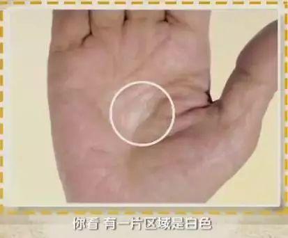 手诊10种常见病从手上就能看出来,手上健康的秘密