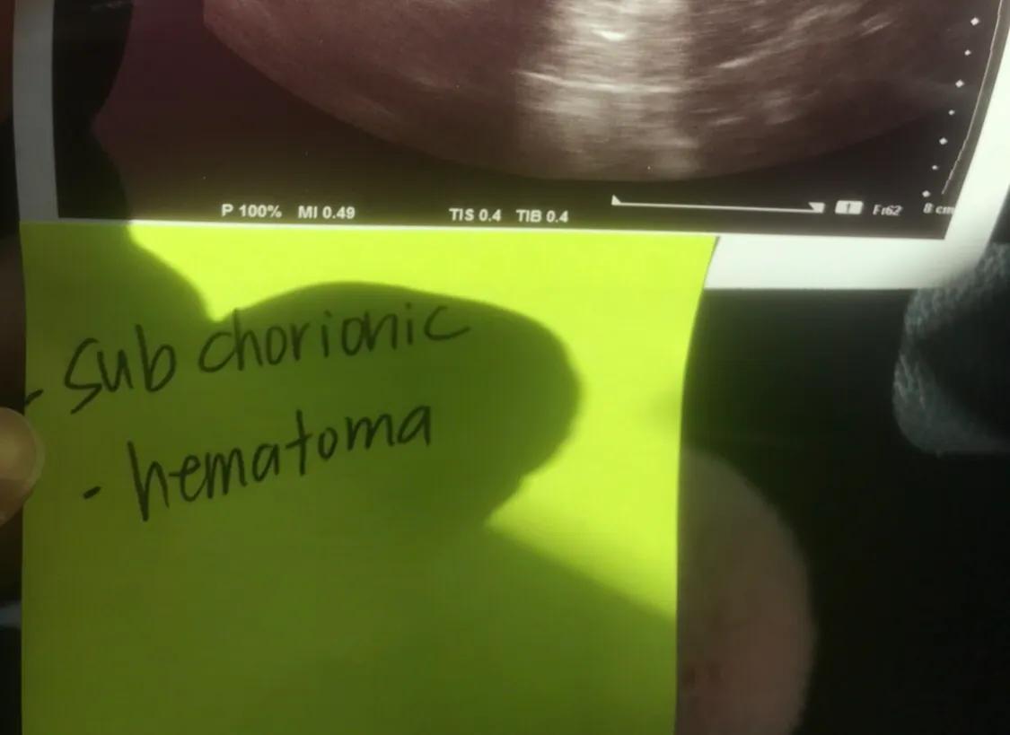 孕期记录生活中的小美好,孕期小视频记录