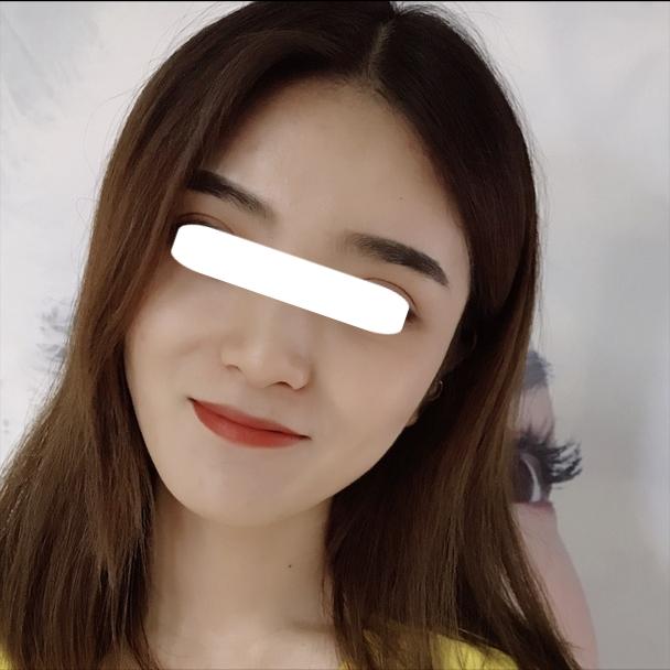 明星为啥要做脂肪填充鼻子,为什么明星喜欢整容