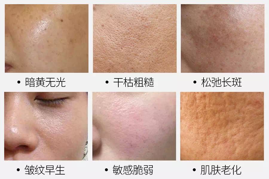 怎样敷水光面膜,明星每天敷面膜