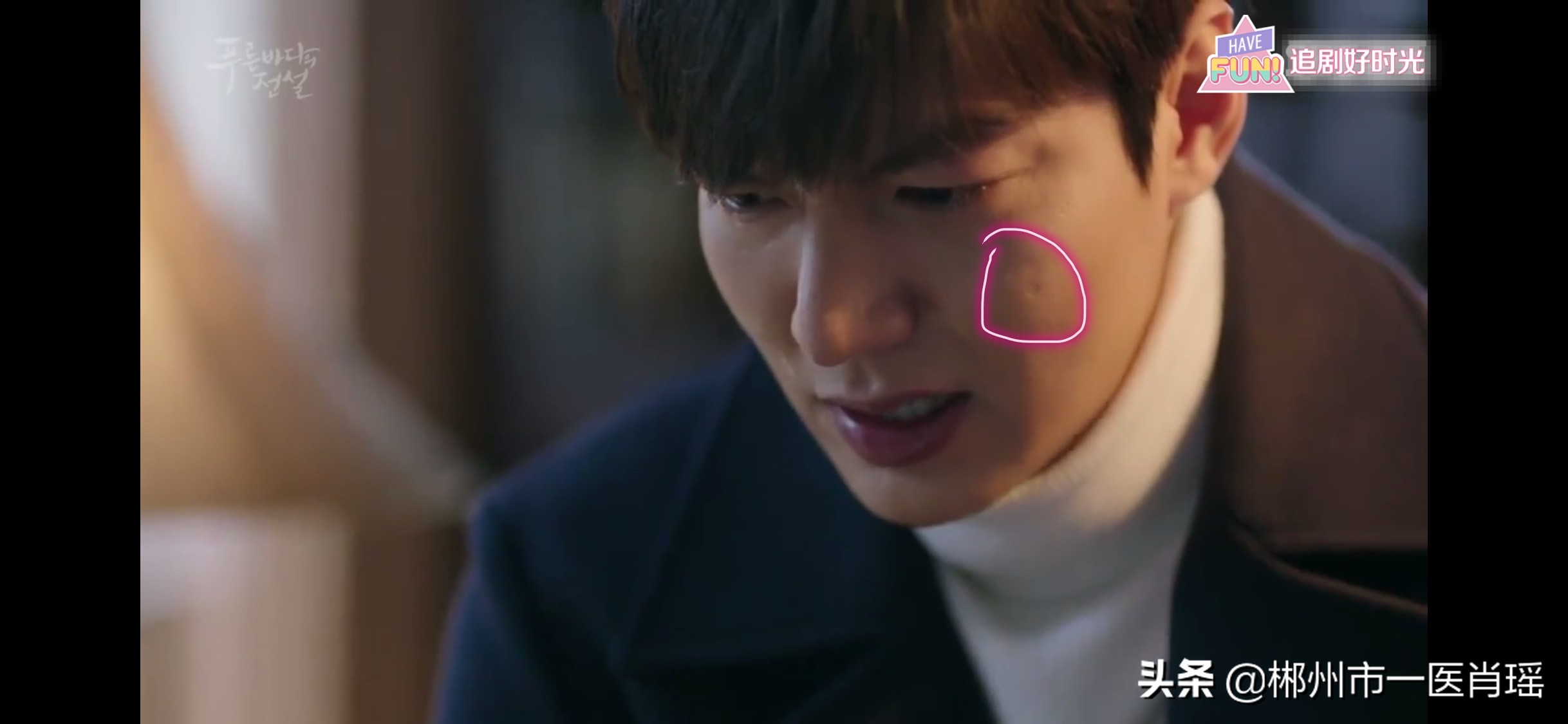 点痣留下的凹坑用点阵激光,为什么激光点痣会留疤