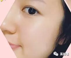 欧阳娜娜推荐的美白神器,欧阳娜娜推荐的祛痘神器