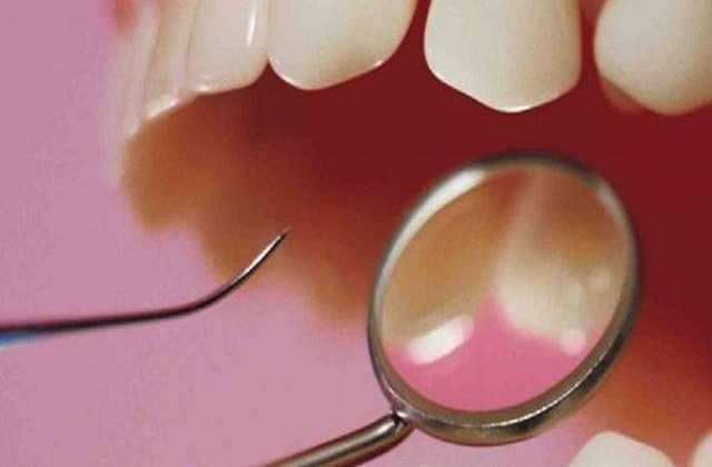 牙龈一直肿胀出血怎么办,牙龈肿胀怎么治疗最快